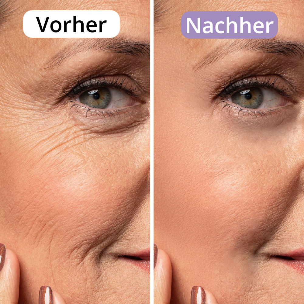 AveraSkin - Silikonpflaster gegen Narben und Falten